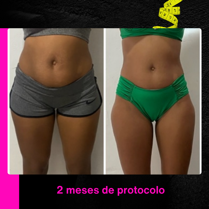 Antes e Depois 4